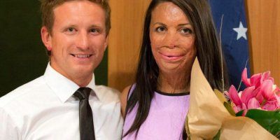 ROMANTIKA NA KVADRAT: &ldquo;Kupio sam prsten dok je još bila na intenzivnoj, prije 4 g.&rdquo;