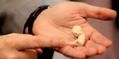 Slijepi par &ldquo;vidi&rdquo; svoje nerođeno dijete zahvaljujući brižnim doktorima