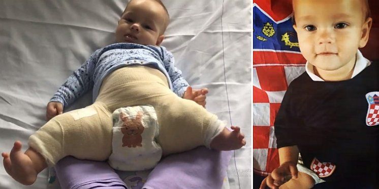 POMOZIMO BEBI ŠIMUNU DA DOBIJE &ldquo;NOVE NOGICE&rdquo;