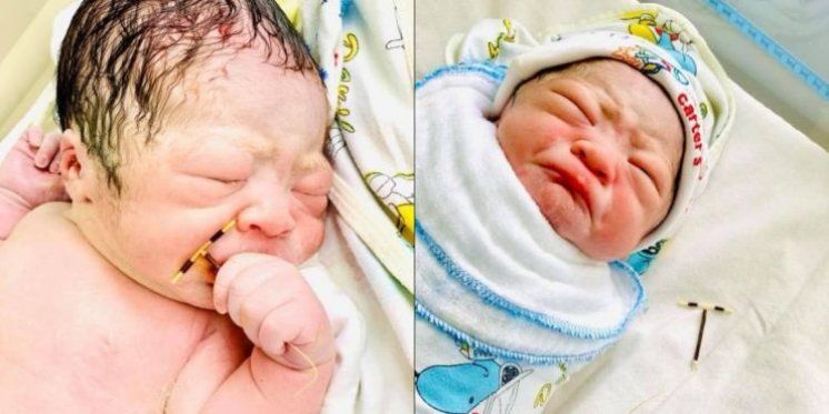 Liječnici zabilježili 'pobjedu života': Beba se rodila sa spiralom u ruci