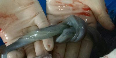 Liječnik mi je povikao - ' Požuri tata, slikaj ovo, vaša beba je čudo!'