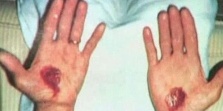 &bdquo;Obični&ldquo; čovjek koji je imao stigme - 365 dana u godini proživljavao Muku Kristovu